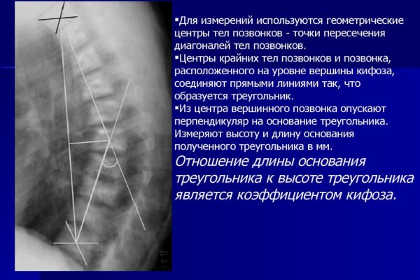 Кракен маркетплейс что там